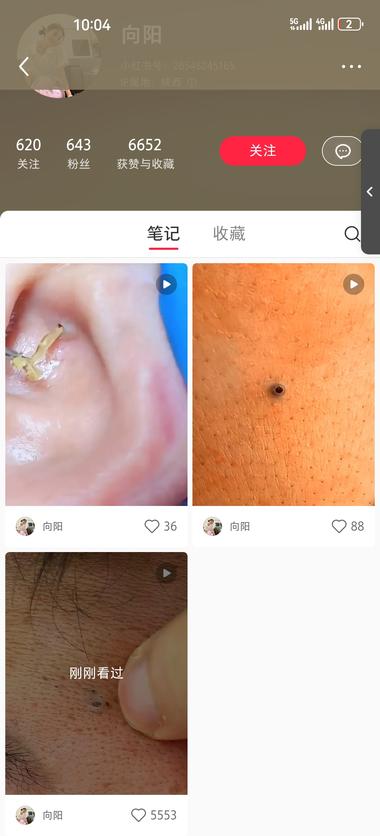 一个异常值，通过发布拔黑头..#风向标-搞钱风向标论坛-航海社群内容-航海圈